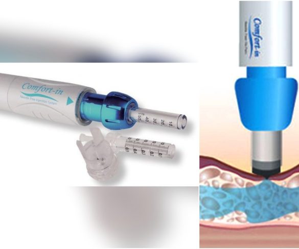 Así funciona primera jeringa sin agujas y que no provoca dolor: Ya está en Chile